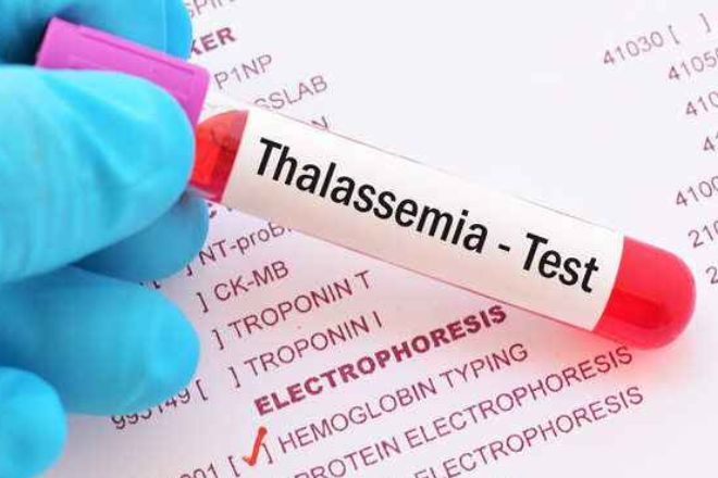 Thalassemia screening